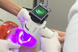 VELscope®Vx(ベルスコープ)を使った検診・写真撮影