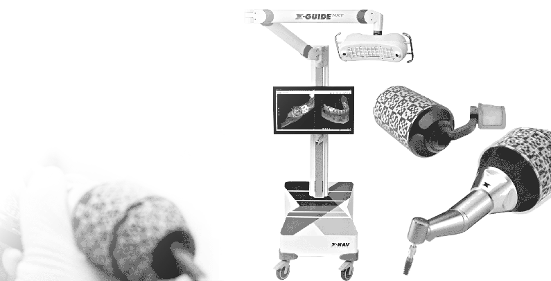 X-Guideシステム
