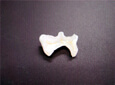 一宮市のインプラントクリニック・オーキッド歯科のオールセラミックインレー施術例
