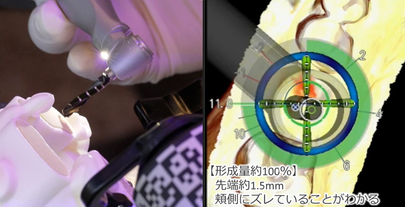 X-Guideシステム
