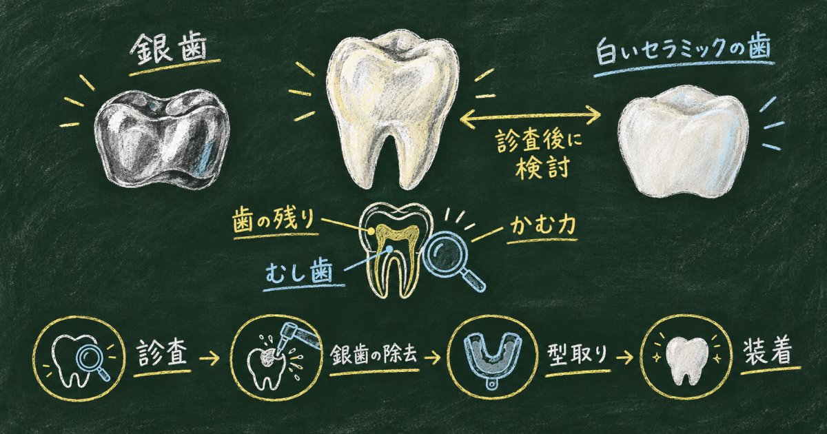 奥歯の銀歯を白くしたいけれど不安？セラミック治療前の相談ポイント
