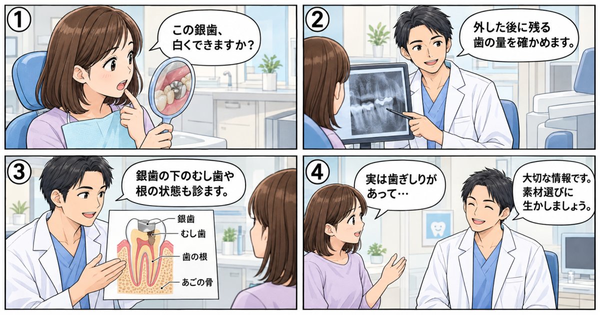 奥歯の銀歯を外せるかは、何を調べて決める?