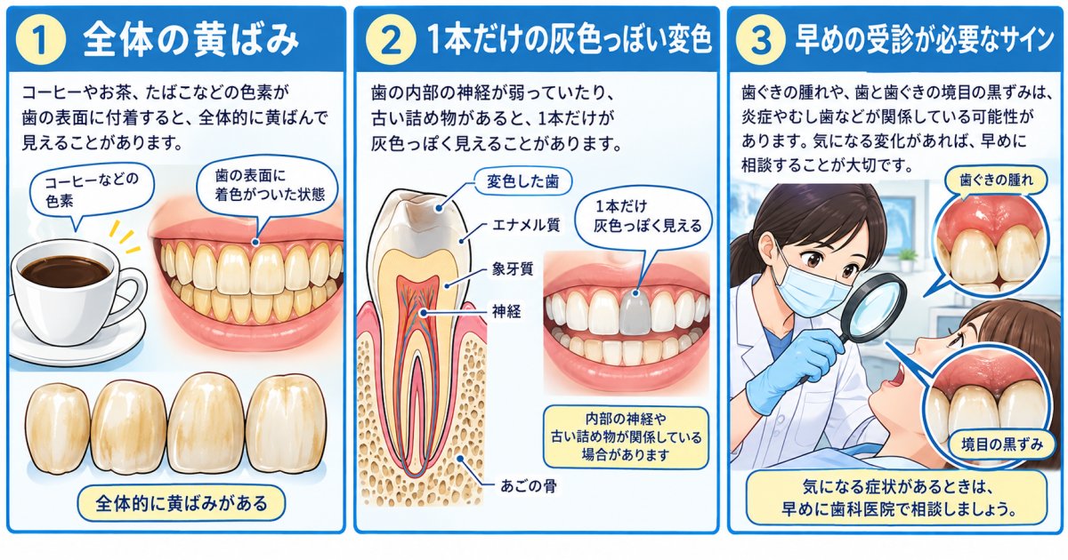 鏡でできる歯の変色セルフチェック:範囲・色調・現れた時期の3つで見る